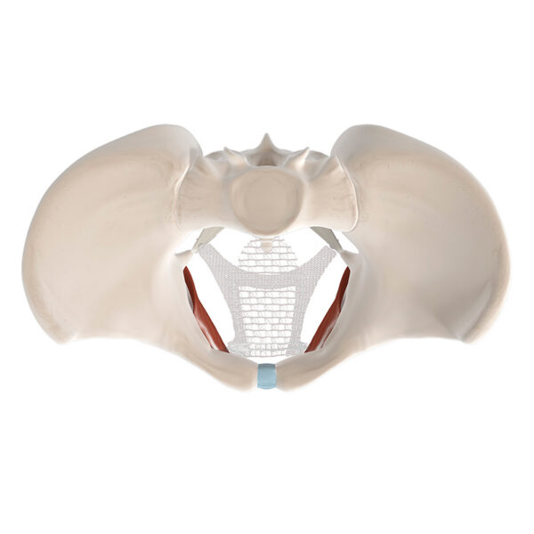 Calistar S – Kit para Reparação do Prolapso Vaginal Anterior e Apical - Imagem 4