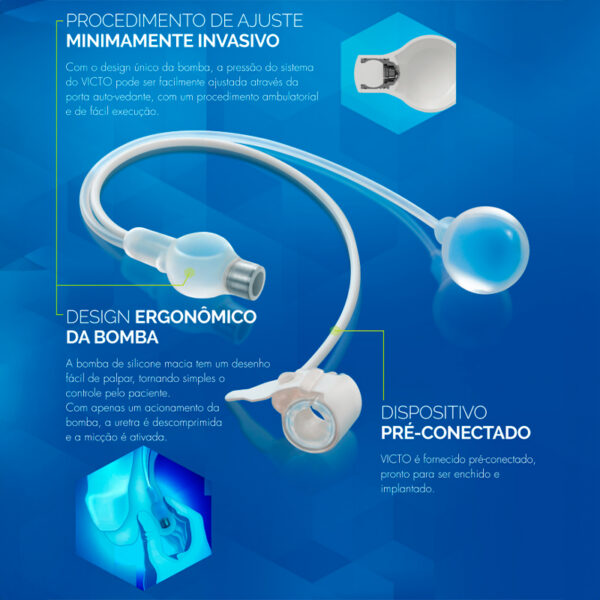 VICTO® – Esfíncter Urinário Artificial Ajustável Masculino - Imagem 2